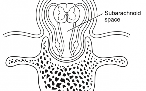 每日一题_2022.12.07