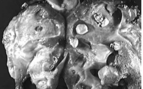 每日一题_2022.12.11