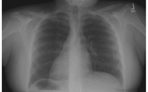 每日一题_2022.12.09