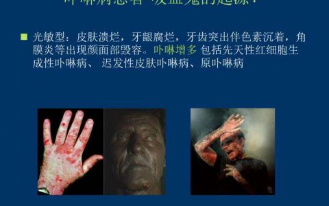 每日一题_2022.12.22