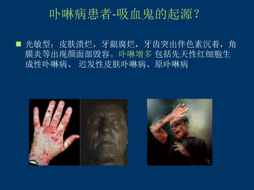 每日一题_2022.12.22