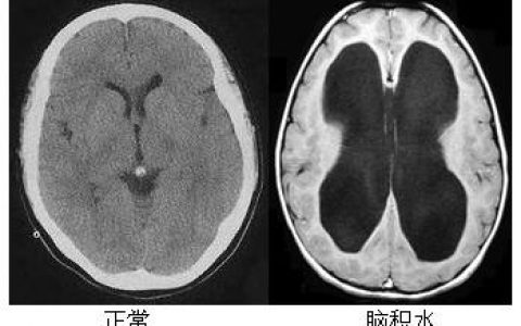每日一题_2022.12.15