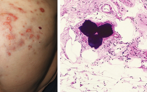 每日一题_2022.12.08