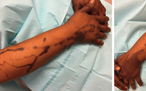 每日一题_2022.12.17