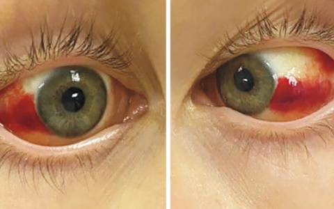 每日一题_2022.12.23