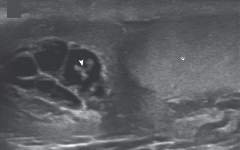 每日一题_2022.12.02