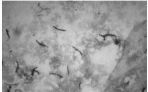 每日一题_2023.01.08