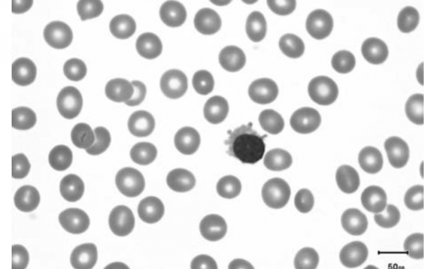 每日一题_2023.01.14