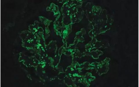 每日一题_2023.01.02