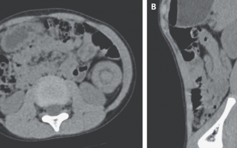 每日一题_2023.01.13