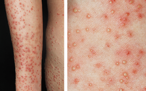 每日一题_2023.01.23