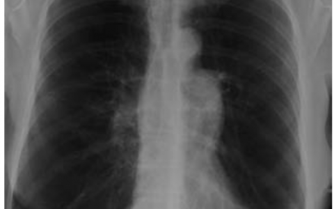 每日一题_2023.02.07