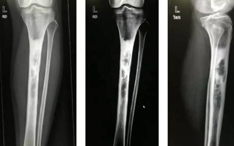 每日一题_2023.02.26
