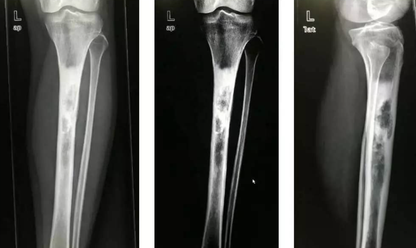 每日一题_2023.02.26