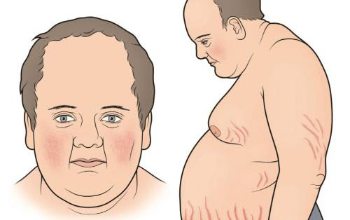 每日一题_2023.02.14