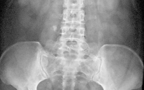 每日一题_2023.02.06