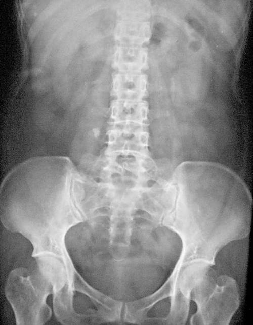 每日一题_2023.02.06