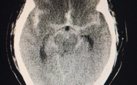 每日一题_2023.02.15