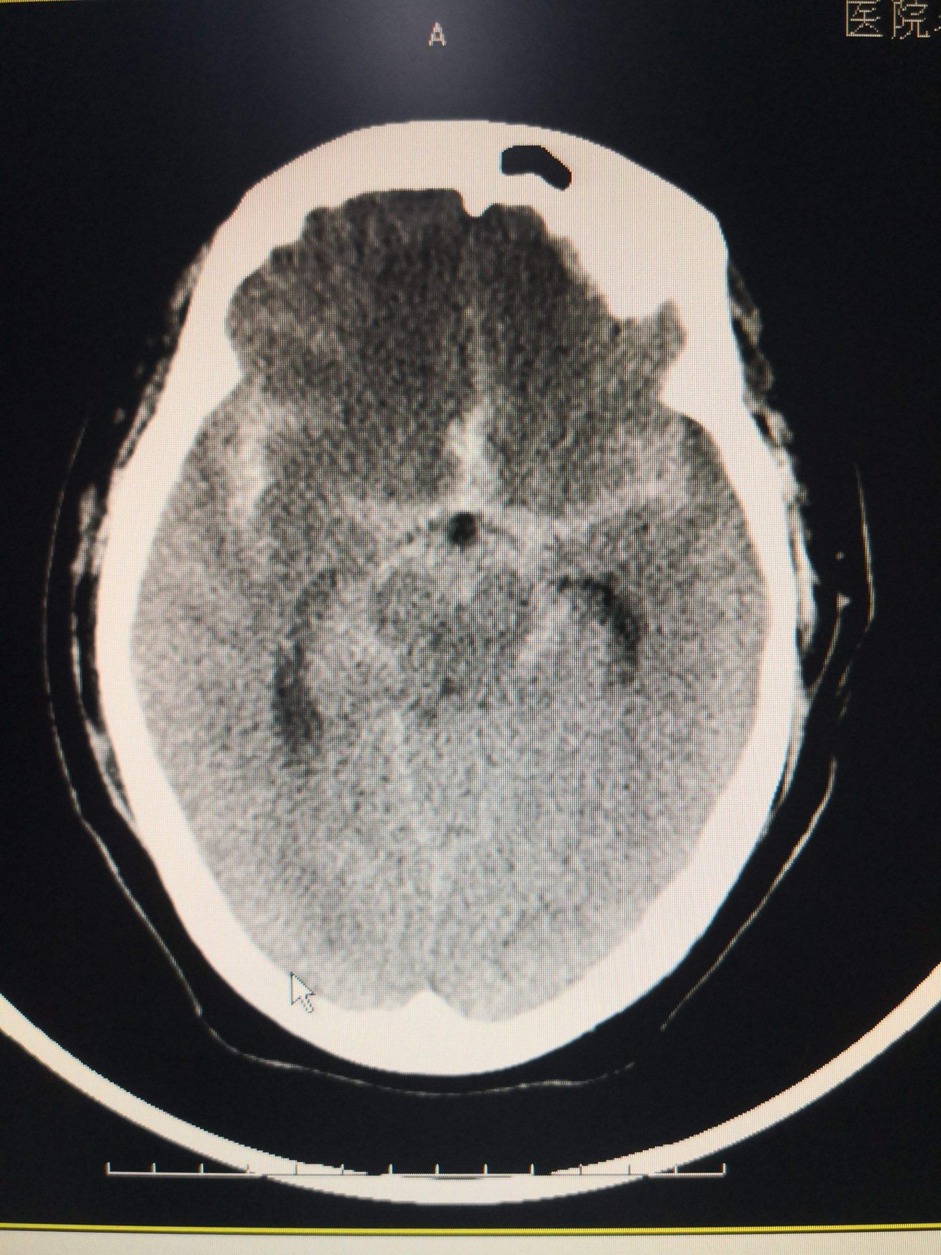 每日一题_2023.02.15