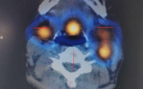 每日一题_2023.02.01