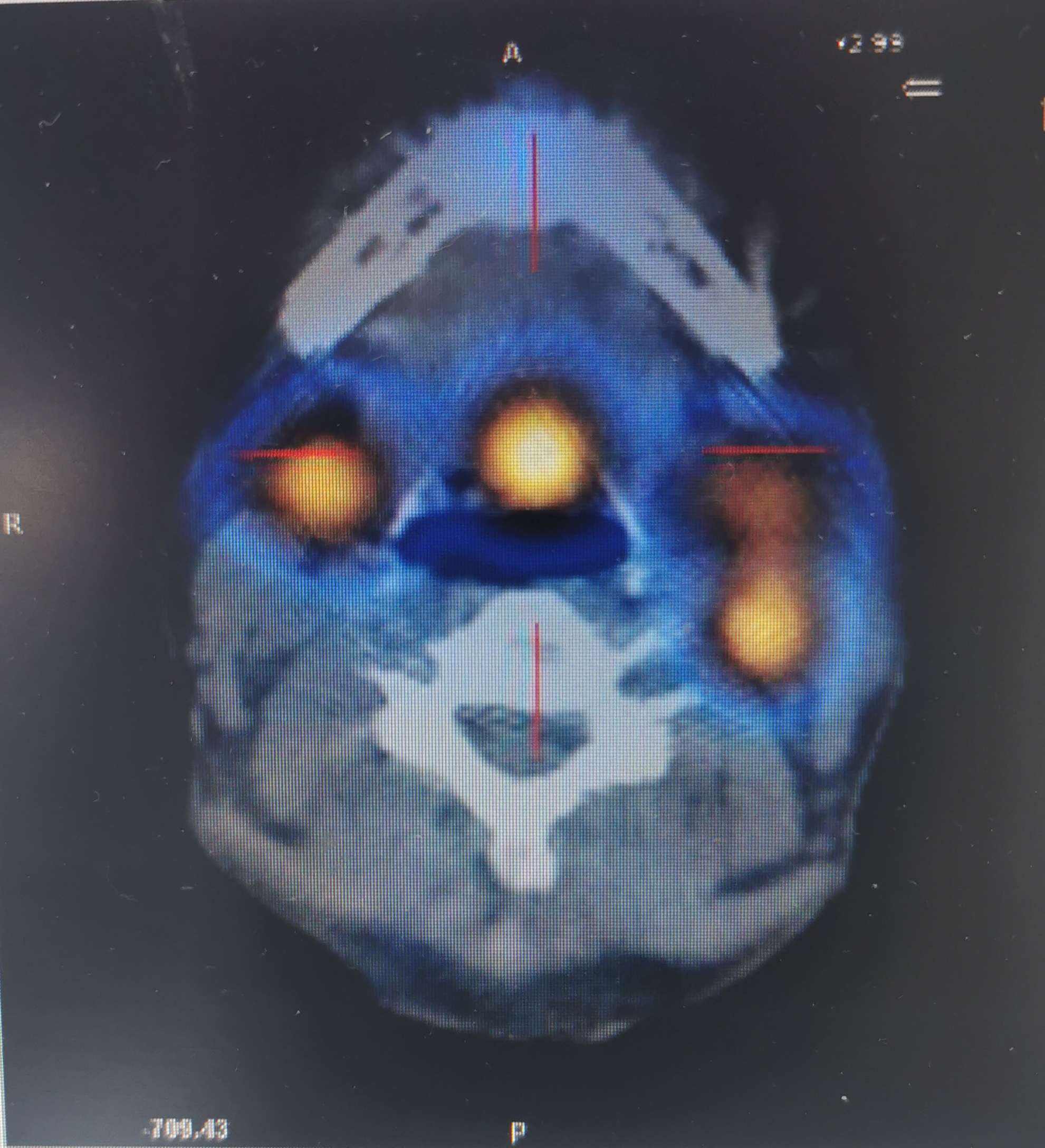 每日一题_2023.02.01
