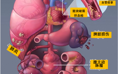 心肺原因导致的腹痛