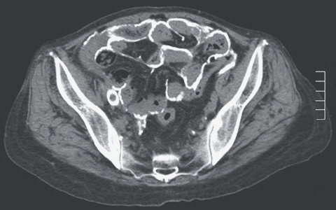 每日一题_2023.02.24
