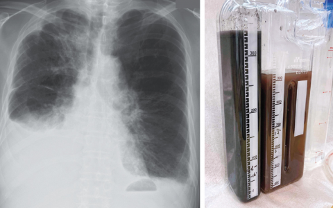 每日一题_2023.02.09