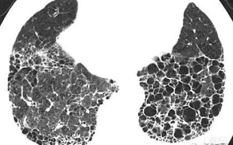 每日一题_2023.03.25