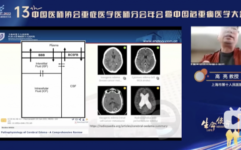 脑水肿的高渗治疗_上海十院高亮