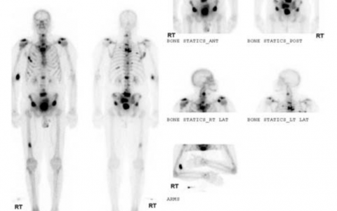 每日一题_2023.03.11