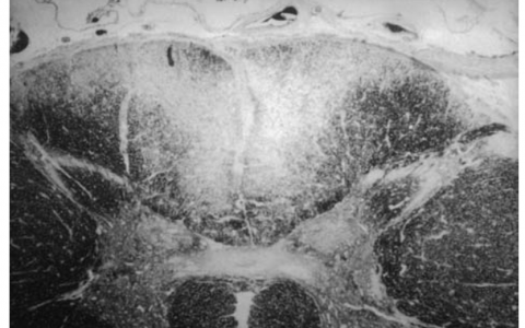 每日一题_2023.03.21