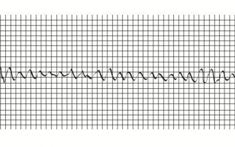 每日一题_2023.03.24