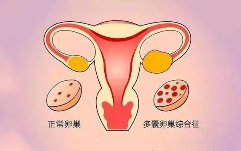 每日一题_2023.03.26