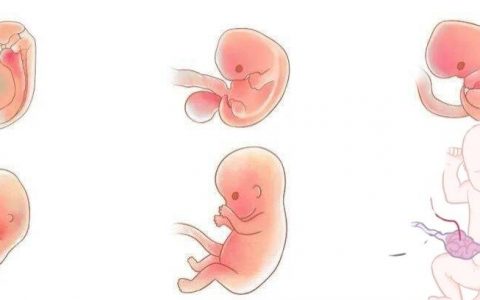 每日 一题_2023.03.20