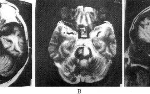 每日一题_2023.03.04