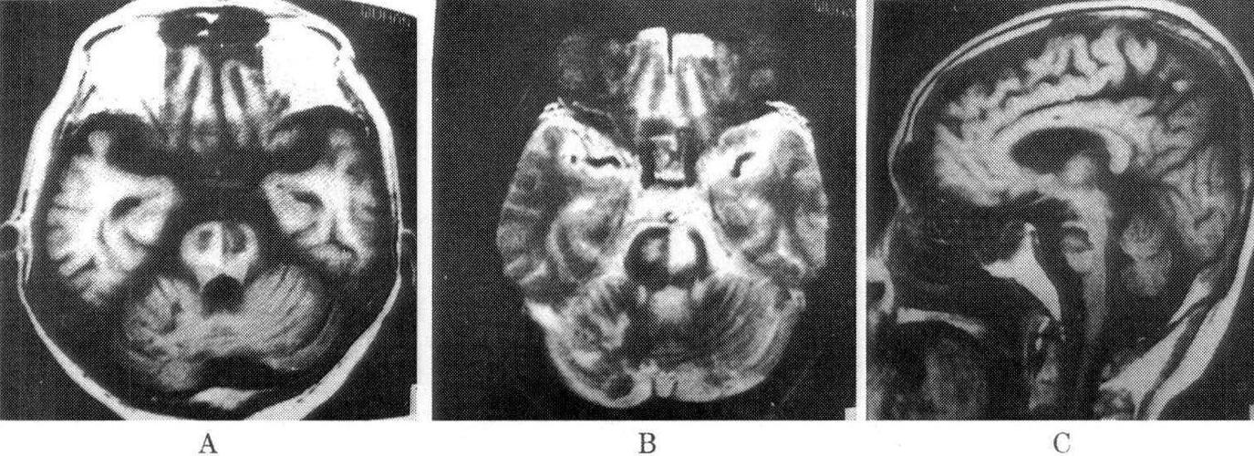 每日一题_2023.03.04