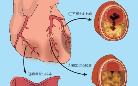 每日一题_2023.03.13