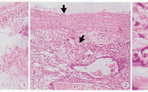每日一题_2023.03.19