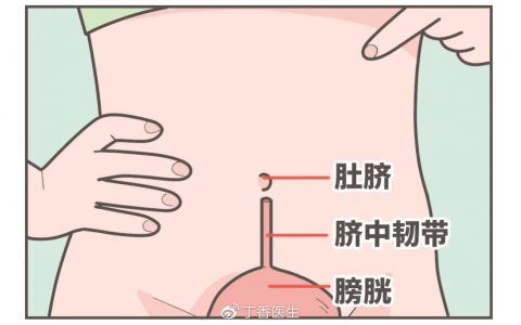 每日一题_2023.03.05