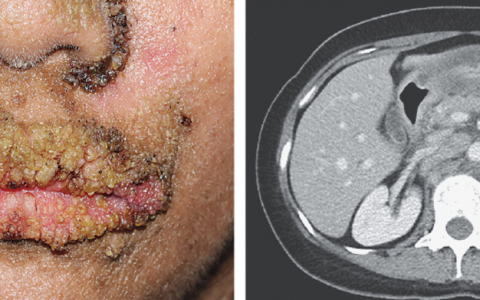 每日一题_2023.03.09