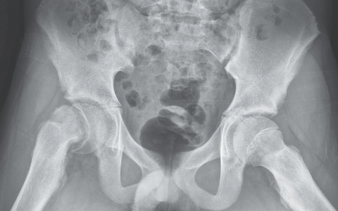 每日一题_2023.03.17