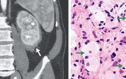 每日一题_2023.03.03