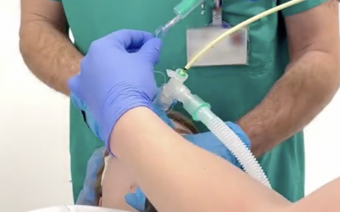 NEJM：更换气管插管