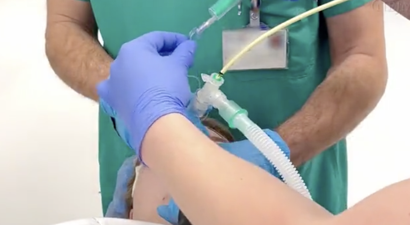 NEJM：更换气管插管