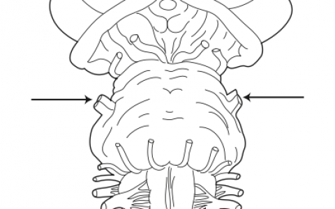 每日一题_2023.04.23