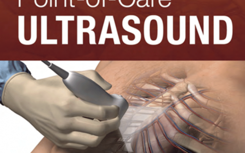 超声书籍：Point-of-Care ULTRASOUND