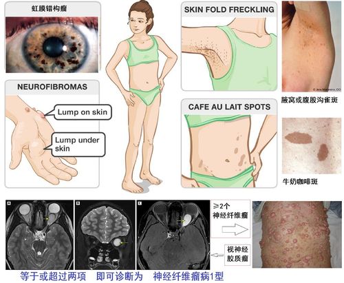 每日一题_2023.04.12