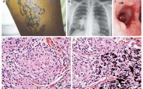 每日一题_2023.04.04