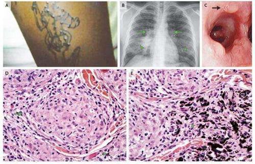 每日一题_2023.04.04